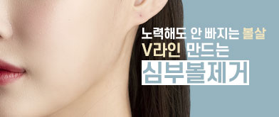 심부볼지방제거로 감쪽같이 V라인으로